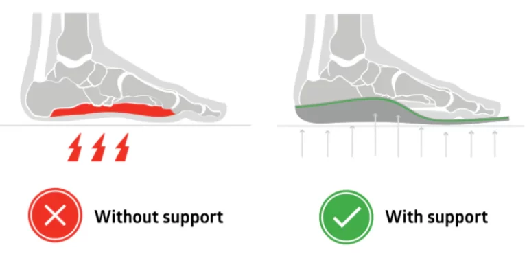 Wearing Unsupportive Shoes Can Cause Back Pain: MD Podiatrist 