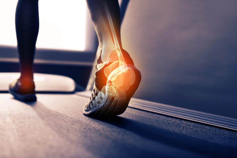 MD Podiatrist Highlights Spring Surge in Heel Pain and Sports Injuries