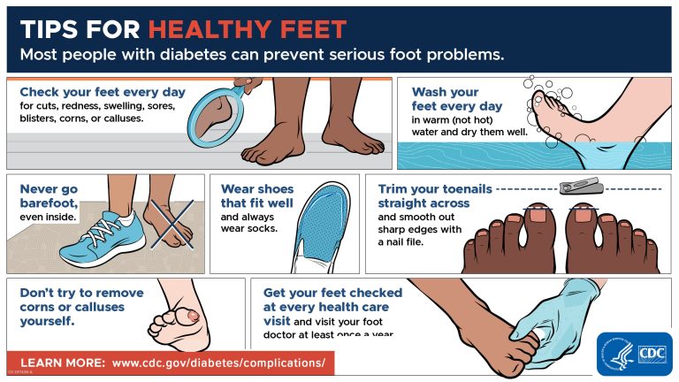 People with Diabetes Face Unique Risks: MD Podiatrist